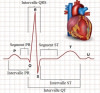 L’Electrocardiogramme (ECG)