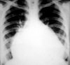 La radiologie / radiographie