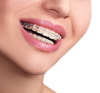 Soins Orthodontiques