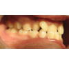 Orthodontie et pédodontie