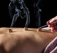 La moxibustion