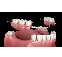 Service de prothèse dentaire