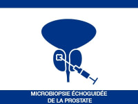 Microbiopsie échoguidée de la prostate