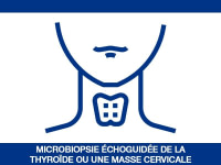 Microbiopsie échoguidée de la thyroïde ou une masse cervicale