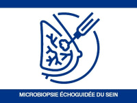 Microbiopsie échoguidée du sein