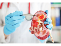 Dépistage des maladies rénales