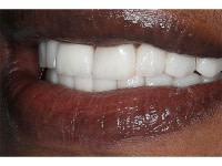 Dentisterie & Esthétique du Sourire