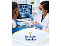 Implants dentaires