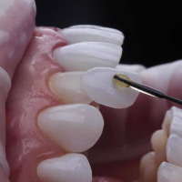 DR. MANIWA CHIRURGIEN DENTISTE PRESTATAIRE