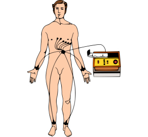 Electrocardiographie