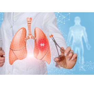 Chirurgie thoracique