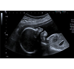 Radio – Échographie