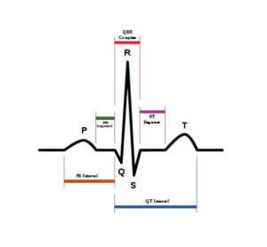 ECG (Électrocardiogramme)