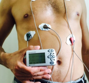 Holter ECG